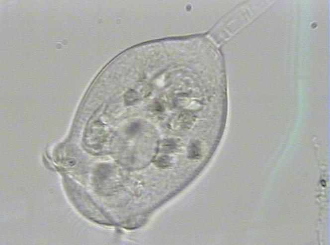 Vorticella