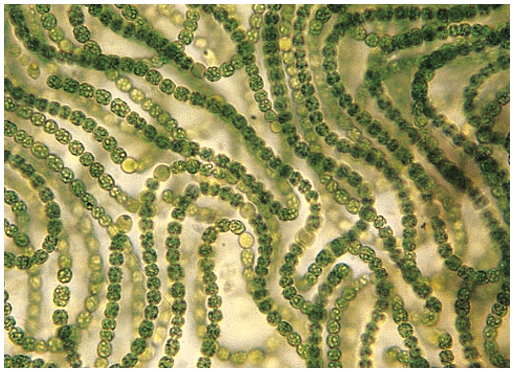 Fotosyntetizující cyanobakterie Anabaena (zvětšení 450 x).
