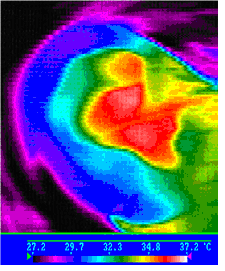 Obr. 26 Termogram ušního boltce: zvukovod je jasně viditelná oblast pohybující se v rozmezí od 34,8 C do 37,2 C, tuto informaci lze využít pro detekci a lokalizaci ucha pomocí termogramu (Převzato z