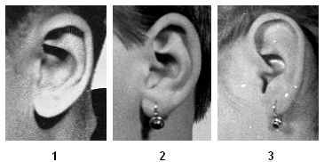 Škála znaku 2 Proporcionalita ušního boltce Boltec kaudální (1), souměrný (2) a kraniální (3) Znak 3: Celkový tvar ušního boltce Tvar boltce lze z fotografie určit podle obrysu boltce.