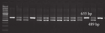 Obrázek 2: Vzorový elektroforeogram kodominantního markeru Md ACS1 CZU Marker Md ACO1 CZU Experimentálně bylo zjištěno, že původně navržený PCR marker pro detekci delece v lokusu Md ACO1 (Costa et al.