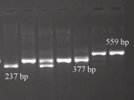 PCR marker AD13 SCAR CZU2 lokusu Rvi4 U vazebného PCR markeru AD13 SCAR CZU2 jsou elektroforetickou separací detekovány rozdíly typu delece.