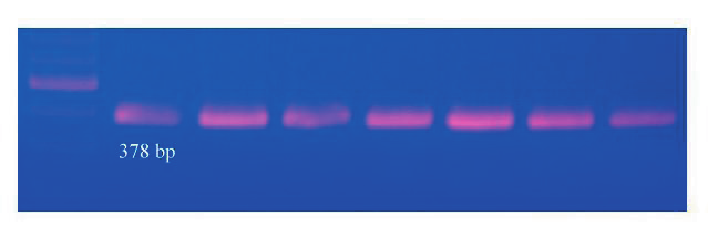 Podmínky PCR amplifikace Složení reakční směsi (12,5 μl) pro primerový pár ARGH17 F/R: 2 ng genomové DNA; 1 U Taq polymerázy (Roche); BSA 0,5 μg/12,5 μl; 10 mm Tris HCl (ph 8,8); 50 mm KCl; 2 mm MgCl