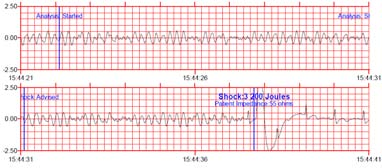 AED - Automatické externí defibrilátory Principem defibrilace je