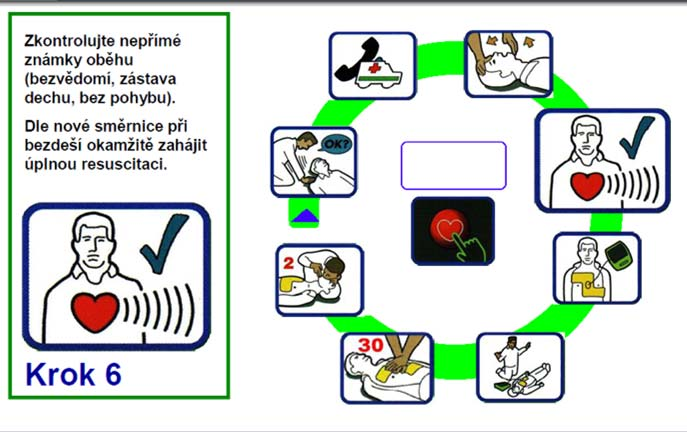 POSTUP RESUSCITACE kontrola