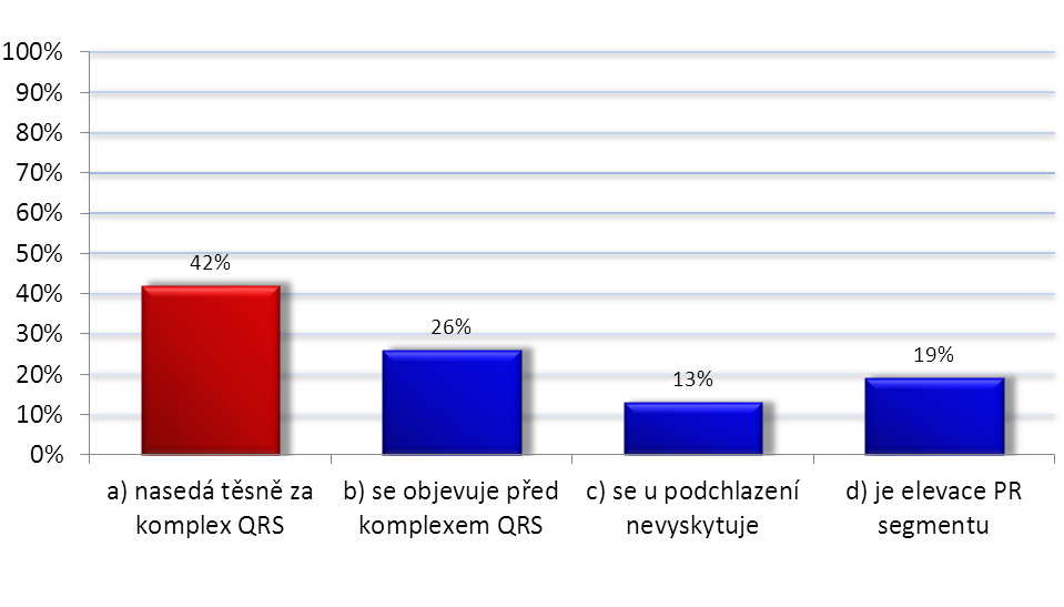 Graf 14: Osbornova vlna Zdroj: Vlastní výzkum Z celkového počtu 76 (100 %) respondentů označilo možnost a) 32 (42 %), možnost b) 20 (26 %)
