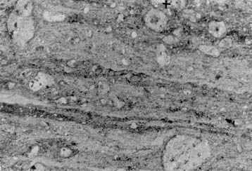columnals: section of cupressocrinid columnal, most likely of the genus Cupressocrinites (marked by cross).