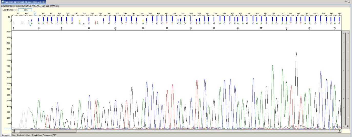 5.3 Sequence Scanner v1.0 Sequence scanner v1.0 je volně dostupný software od firmy Applied Biosystems (APPLIED BIOSYSTEMS, 2012).