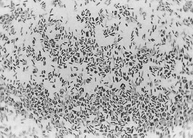 -lipoproteiny Escherichia coli