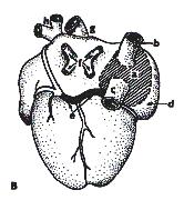 , 1985) Obrázek 12 Vývoj a osud sinus venosus (Klika a kol., 1985) Legenda: A) Embryo 26.