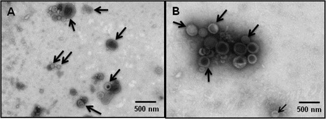 Transmisní el. mikroskopie negativně barvených OMV u C.jejuni OMV u divokého kmene C. jejuni 11168H (A) a kmene 81-176 (B) s intaktní dvojvrstevnou membranou.