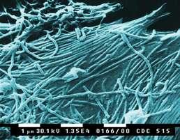 (-)ssrna VIRY - Ebola 1976 první objevení viru v blízkosti řeky Ebola v srpnu 2014 počet nakažených přesáhl 7 000 lidí a počet