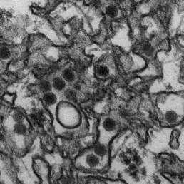(+)ssrna VIRY virus Zika Zika virus (zkráceně ZIKV) je virus patřící do čeledi
