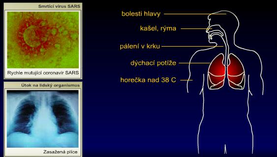 Virus se dostane do dýchacího systému a postupuje níže do plic, což