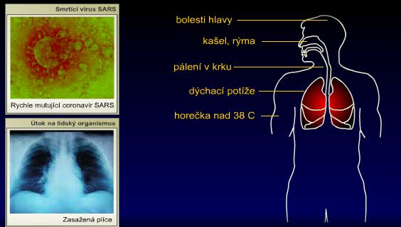 Virus se dostane do dýchacího systému a postupuje níže do plic, což