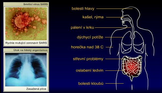 Kromě dýchacího ústrojí však postihuje také