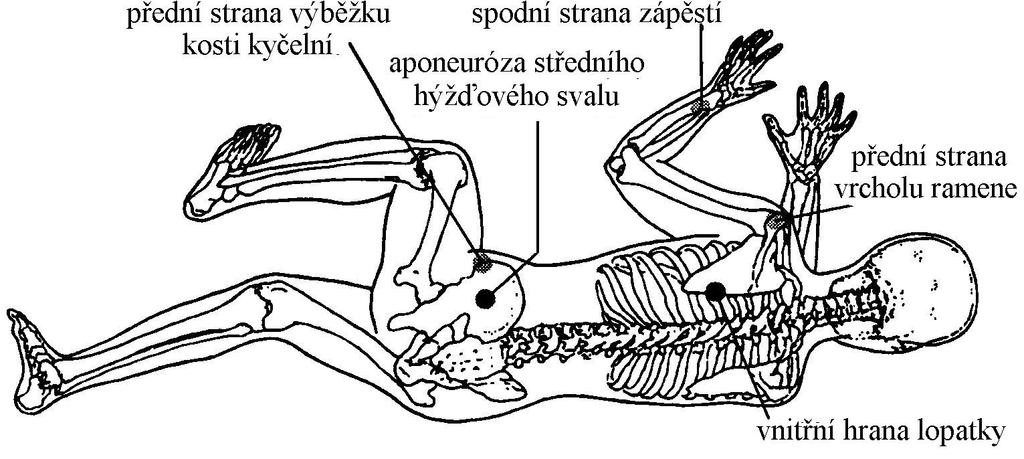 Obr. 5: Výchozí poloha druhé fáze reflexního
