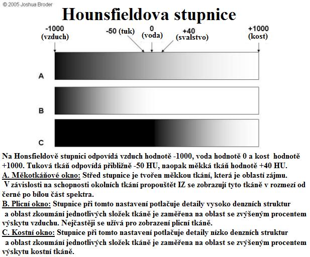 Obrázek 14 Tři druhy oken Hounsfieldovy stupnice (upraveno podle: Broder, 2011) Uspořádání pracoviště Pracoviště výpočetní tomografie se skládá z ovládací místnosti, odkud je zprostředkováno ovládání