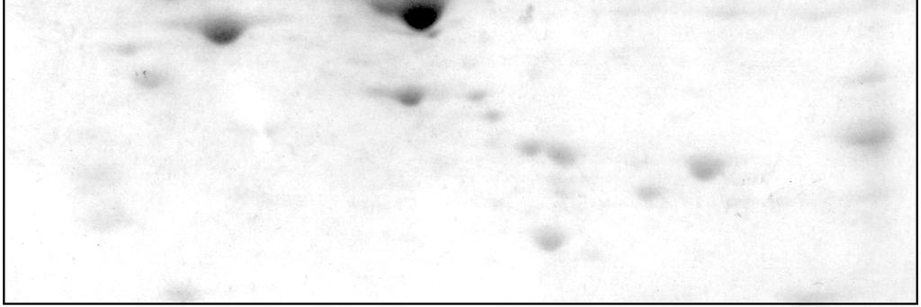 Při optimalizaci přípravy vzorku jsme se zaměřili především na zlepšení solubility proteinů, abychom dosáhli zvýšení celkového počtu proteinů rozlišitelných 2-DE a zároveň umožnili separaci