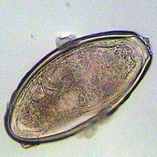 Přílohy Příloha 5: Vajičko Oxyuris equi Seznam příloh Příloha 1: Anoplocephala spp....i Příloha 2: Vajíčko strongylidů...i Příloha 3: Vajíčko Strongyloides westeri.