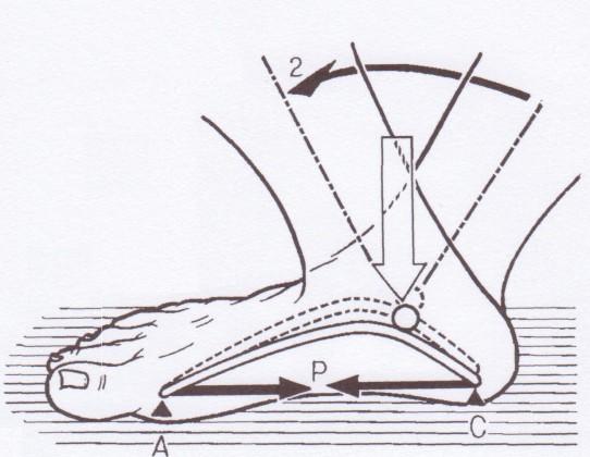 Důvodem je částečný přesun zatížení na přednoží a s tím související odlehčení paty. I. metatarzofalangeální kloub se začíná dorzálně flektovat.