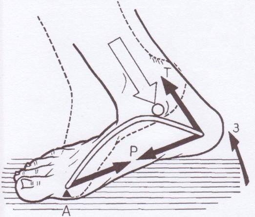 aktivitou m. peroneus longus, kladkovým mechanismem plantární aponeurózy, která přitahuje kalkaneus k přednoží při zvednutí paty.