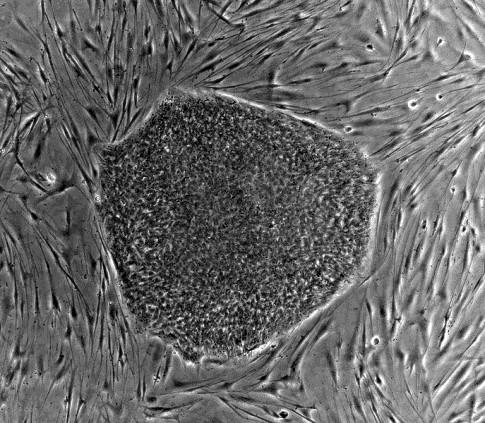 Kmenové buňky Embryonální kmenové buňky - odvozeny