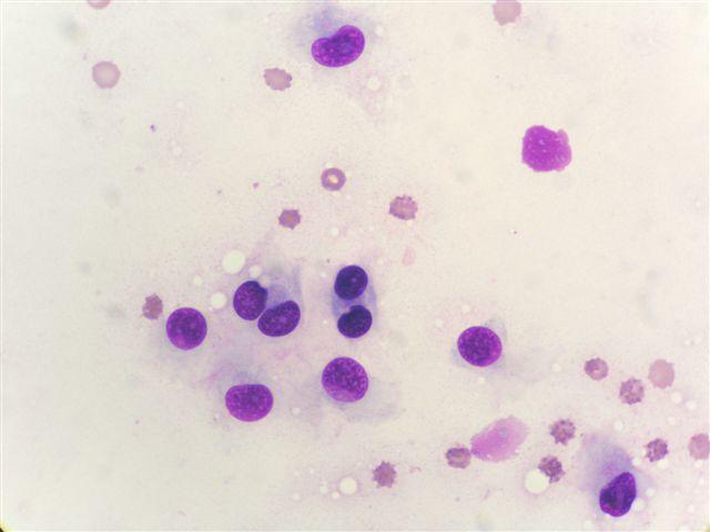 z mastocytů. Cytologická diagnóza: eosinofilní granulom nebo mastocytom. Histologická diagnóza: mastocytom grade II. MayGrünwald/Giemsa, 250x Obr.