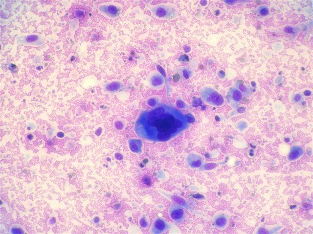 45 Obr. 15: FNAB z útvaru na boku (kočka; samice). Uprostřed snímku se nachází mnohojaderná buňka a v okolí jsou roztroušeny další mezenchymální buňky.