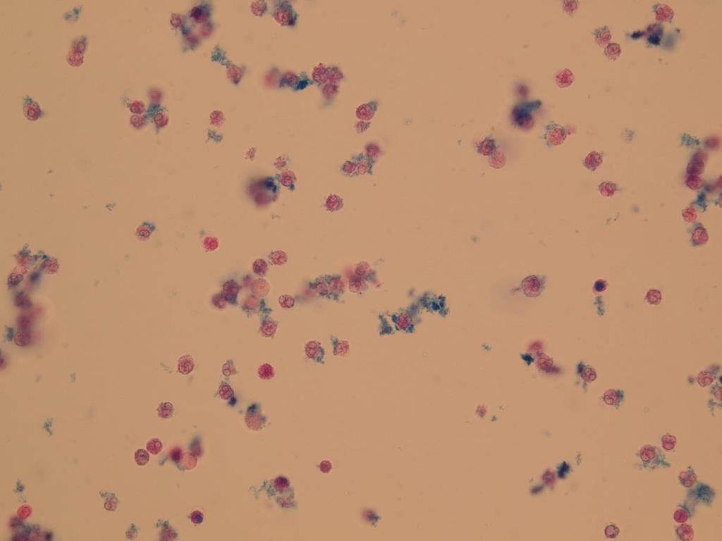 Leukocyty