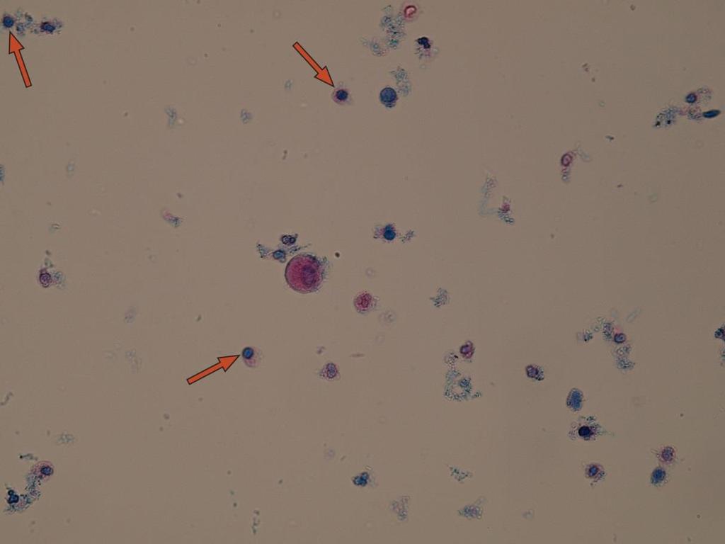 Leukocyty