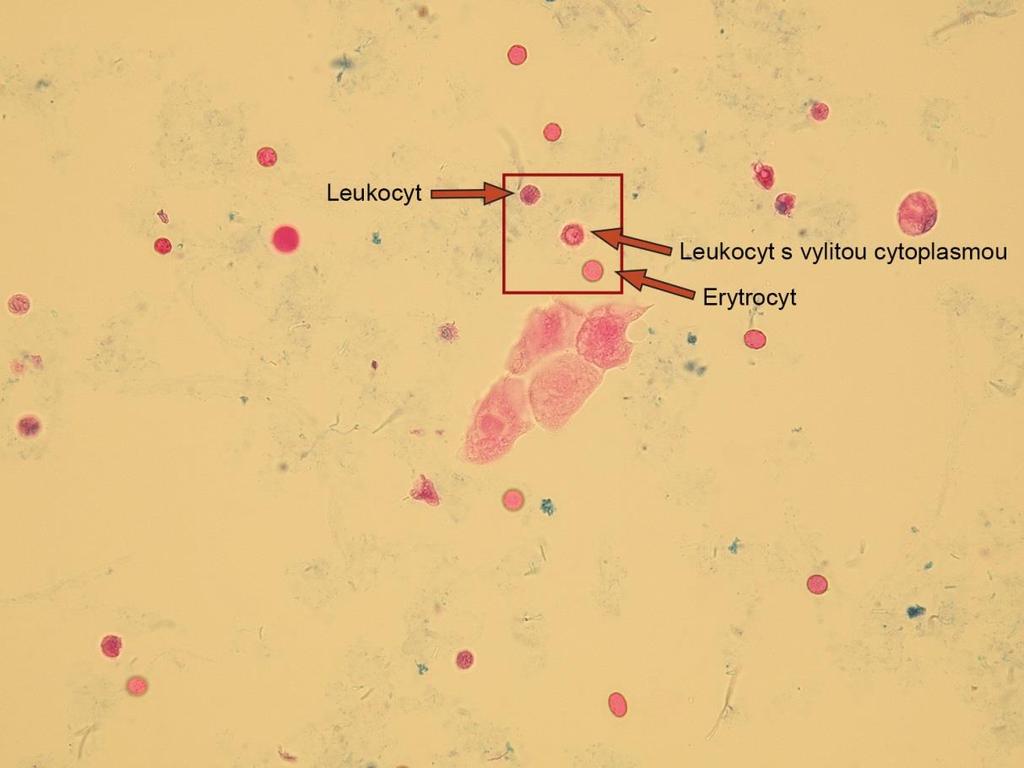 Leukocyty