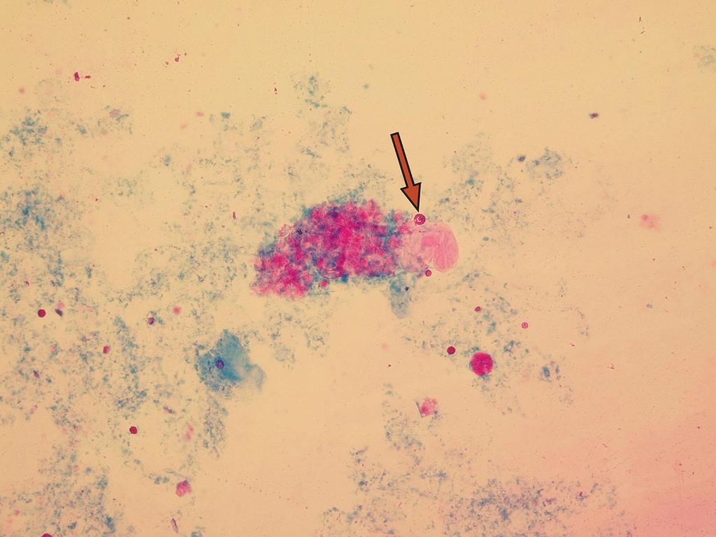 Erytrocyty