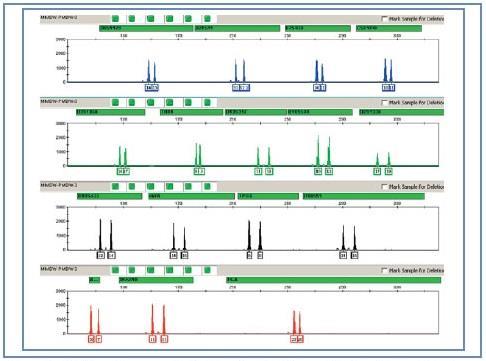 Obr. 29 Grafické znázornění DNA profilu na softwaru GeneMapper Software v4.1 Zdroj: http://str.ausbio.