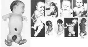 20. století studium toxikologie díky zpřísnění zákonů ohledně prodeje