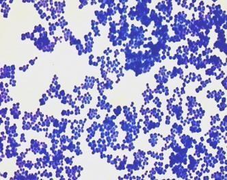 Mikroskopie barvený preparát Jednoduché barvení methylenovou modří nepříliš často používané.