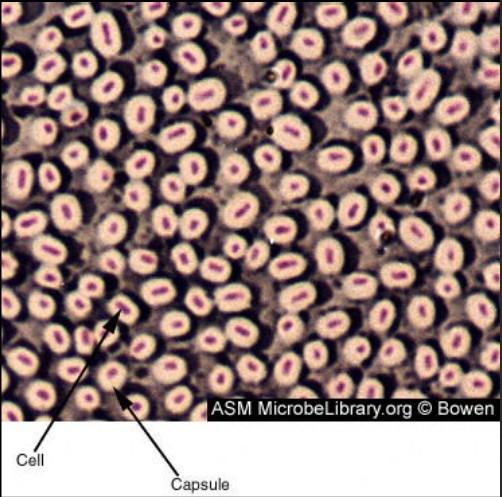 Mikroskopie barvený preparát Barvení dle Burriho: Používá se k barvení pouzder