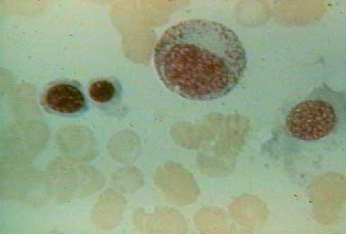 POLYCHROMATOFILNÍ ERYTROBLASTY,