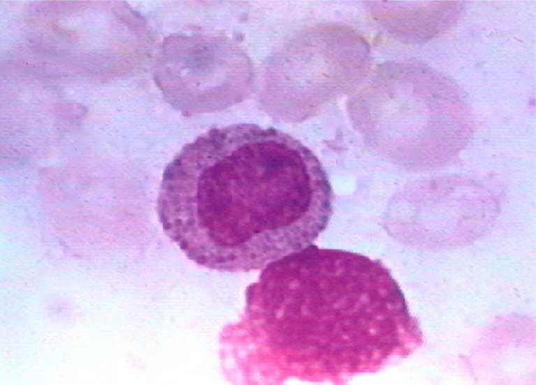 EOSINOFILNÍ