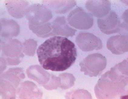 EOSINOFILNÍ