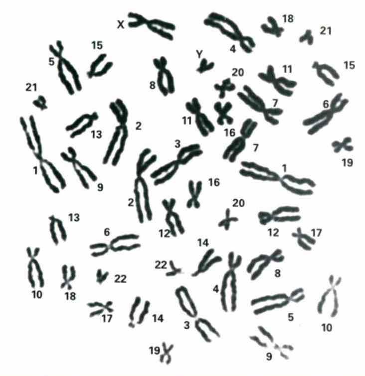 Chromozómy: tyčinkovité útvary, obsahují nukleové kyseliny Buněčné jádro: Pohlavní chromozómy: určují pohlaví jedince Tělová buňka člověka: např.