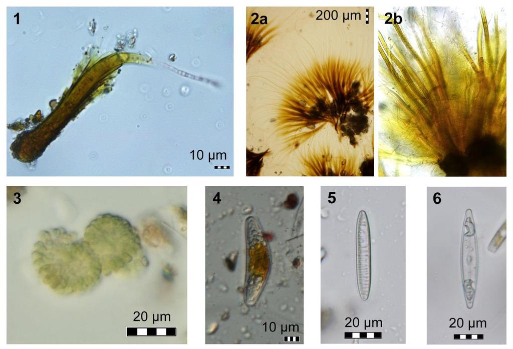 MIKROBIOLOGIE - ALGOLOGIE Obr. 4.4. Typičtí zástupci mikroflóry jezer. Sinice (Cyanobacteria): 1 Calothrix sp.; 2 Rivularia borealis, a kolonie, b detail vláken; 3 Woronichinia sp.