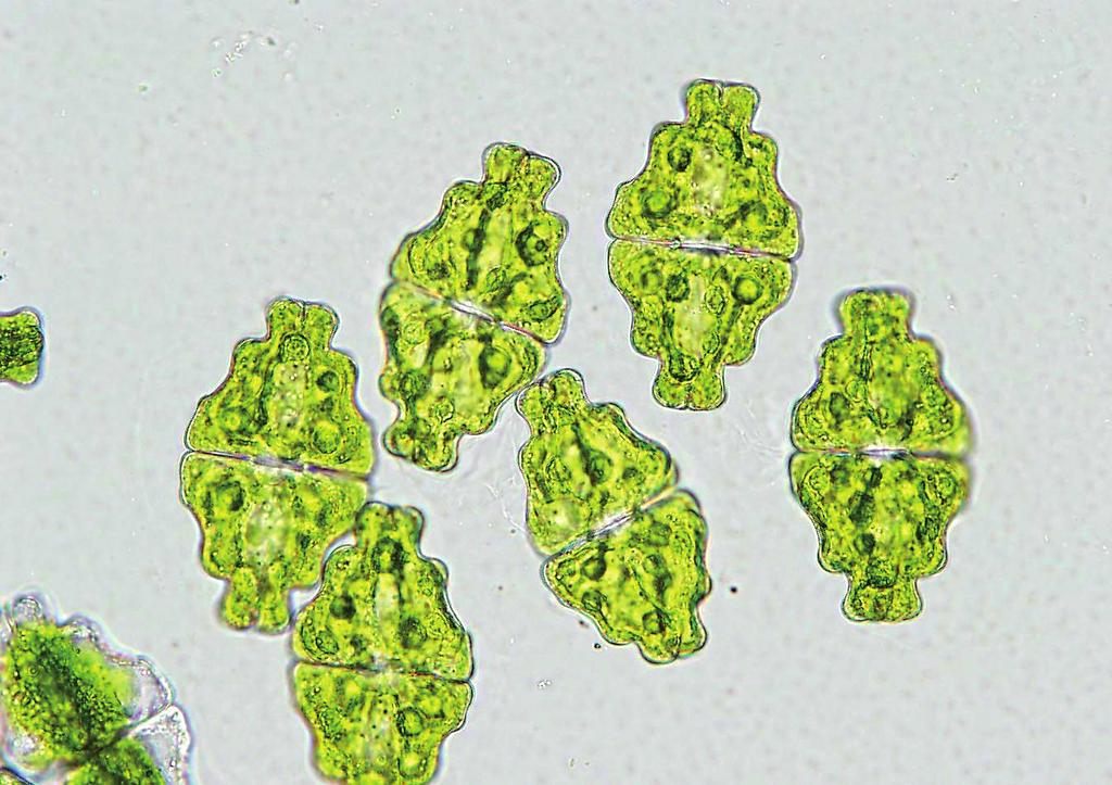 Dva nejběžnější druhy terestrických řas Apatococcus a Trentepohlia nejsou sice ideálním objektem z hlediska vizuálního prožitku při mikroskopování, zato jejich sběr můžeme považovat také za činnost