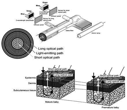 laboratorní technologie 20 Obrázek 1: Optický systém analyzátoru Radiometer ABL 800 FLEX Na reflektanci kůže novorozence se podílejí melanin, zralost kožní tkáně, hemoglobin a bilirubin.