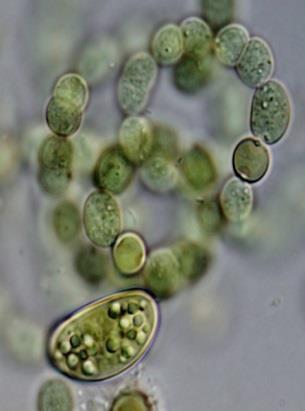 Anabaena