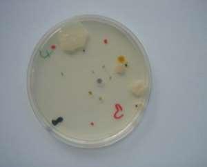 Mikrobiologický ukazatel Úloha v rizikové analýze (příklady) 1. Koliformní bakterie 2. E. coli 3. Intestinální enterokoky 4. Clostridium perfringens 5. Počty kolonií při 22 a 36 C 1.