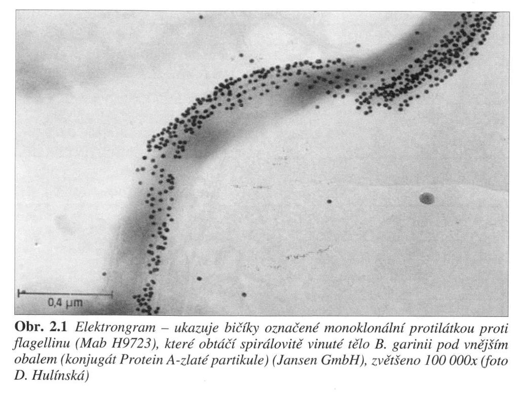 (Bartůněk, 2006, Lymeská borelióza, s.14) 4.2. Růst K růstu, pohybu, životu i virulenci Borrelia burgdorferii je nutná přítomnost bičíků a vnějších povrchových proteinů Osp (Outer surface proteins) buněčné stěny.