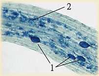 Obr. 3: Kolonizovaný kořen kukuřice obarvený trypanovou modří, (Foto R. Sudová, D. Püschel) 1) vezikuly; 2)