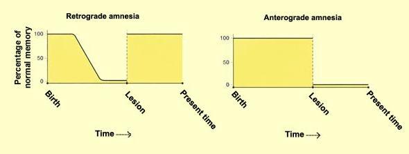 Poruchy paměti Retrográdní amnézie na události před