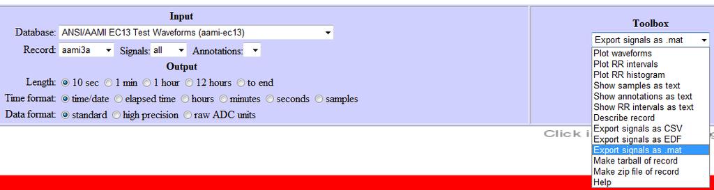 rdann rdsamp setwfdb time2sec wfdb_config wfdbdesc wfdbwhich wrann wrsamp read annotation files for WFDB records read signal files of WFDB records set WFDB paths to default values convert WFDB-format